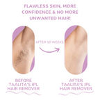 Naldony IPL Hair Remover I The leading laser hair removal for your home