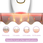 Naldony IPL Hair Remover I The leading laser hair removal for your home