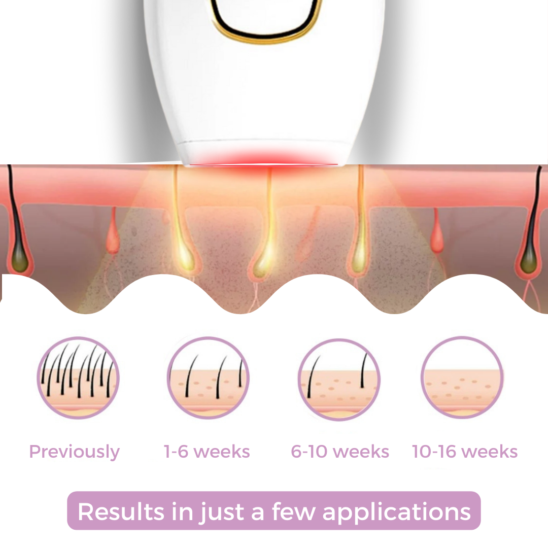 Naldony IPL Hair Remover I The leading laser hair removal for your home