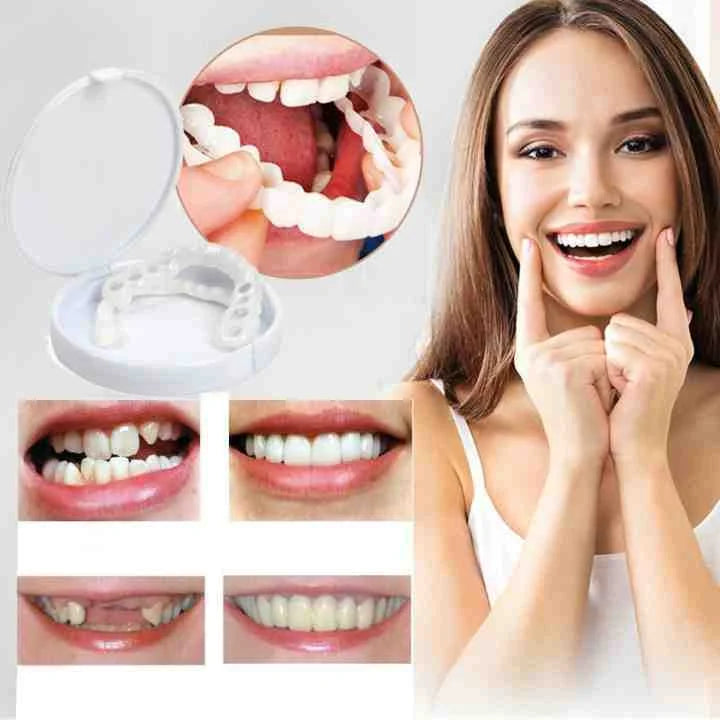 Clip-on dental veneer | Tooth-supported design, no adhesive | For a radiant smile without a dentist visit