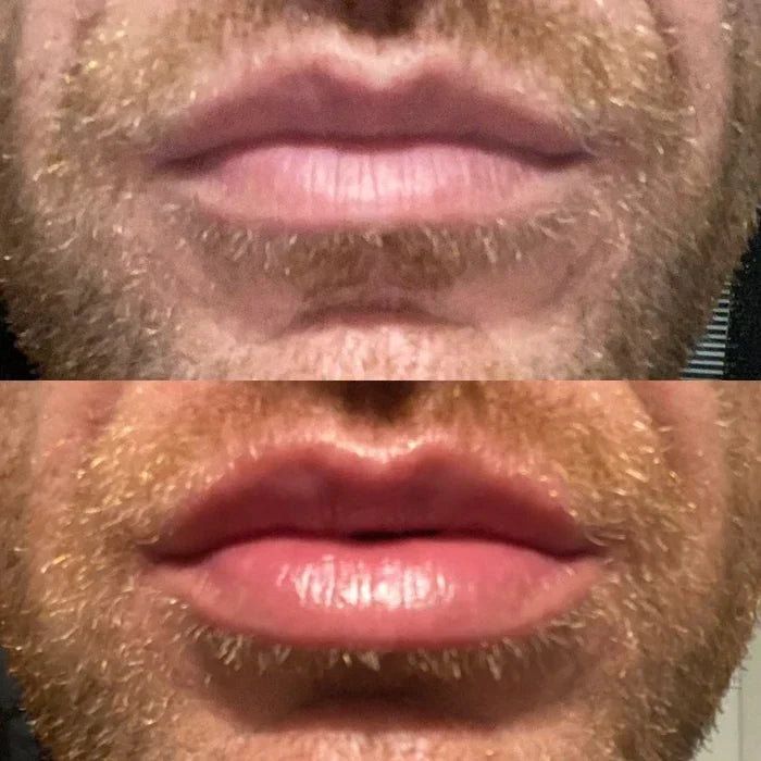 LumaGlow Lip Serum Plumper for Fuller Lips Quickly in Minutes