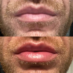 LumaGlow Lip Serum Plumper for Fuller Lips Quickly in Minutes