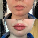 LumaGlow Lip Serum Plumper for Fuller Lips Quickly in Minutes