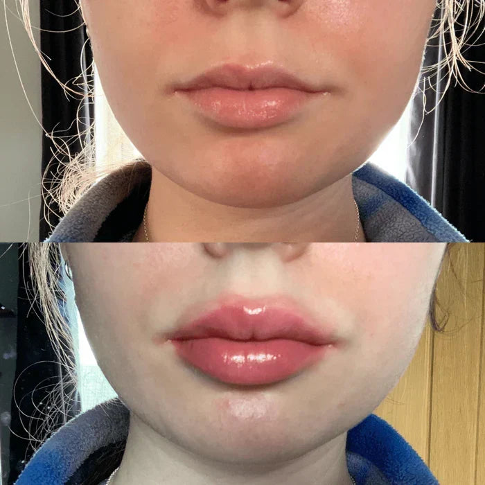 LumaGlow Lip Serum Plumper for Fuller Lips Quickly in Minutes