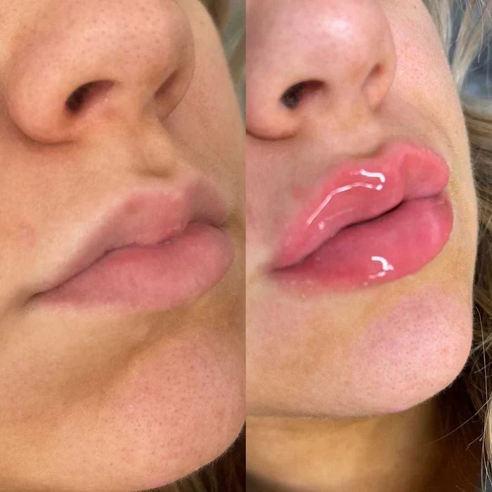 LumaGlow Lip Serum Plumper for Fuller Lips Quickly in Minutes